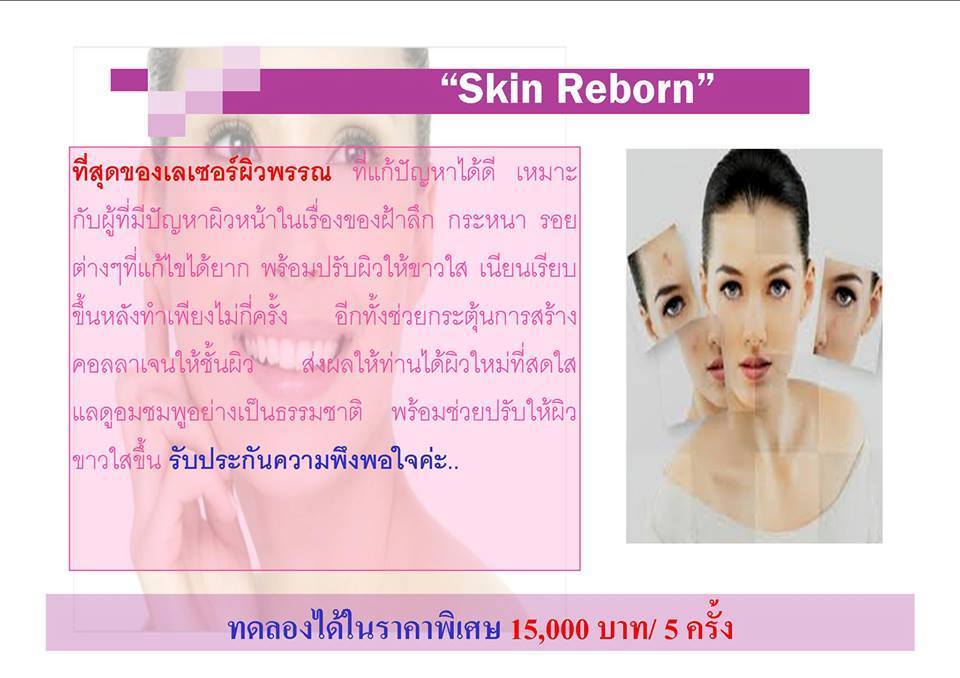 Z4 skin rebon 繼ŷѹѧ